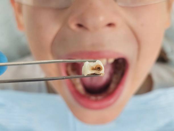 Best Emergency Dental Care for Broken or Chipped Teeth in Langhorne Manor, PA